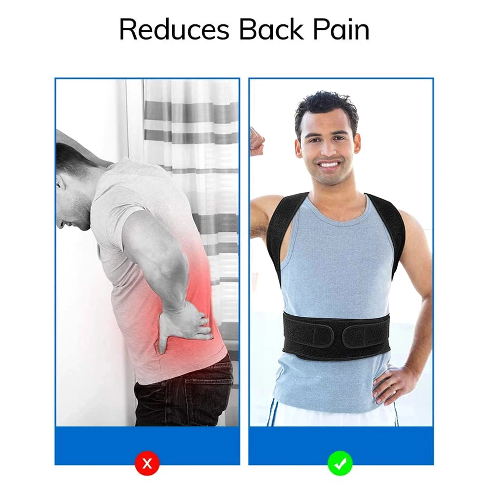MarkhorAthletics™ Back Brace Posture Corrector