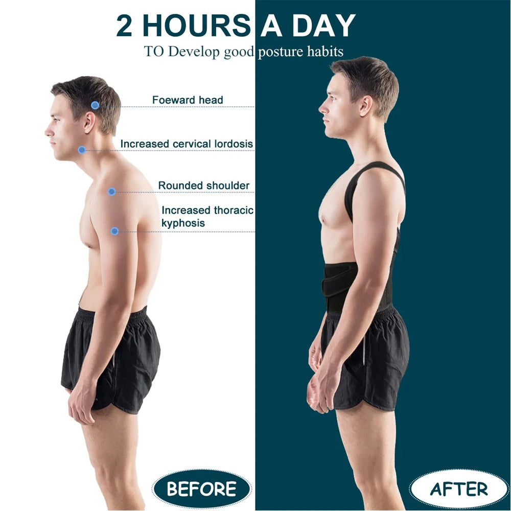 MarkhorAthletics™ Back Brace Posture Corrector